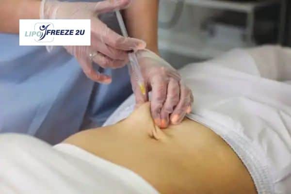 How Does Aqualyx Fat Dissolving Injection Work to Break Down Fat sc?