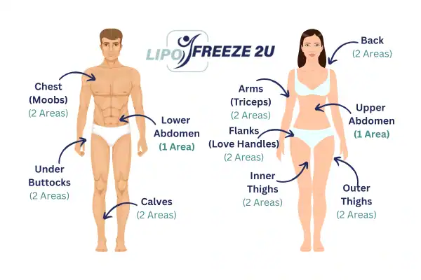 Areas you can have fat freezing treatment sc
