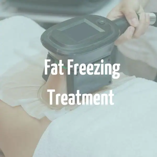 fat freezing treatment sc