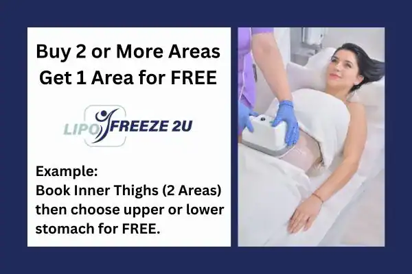 fat freezing prices sc
