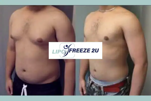 How Long Does It Take to See Results sc?