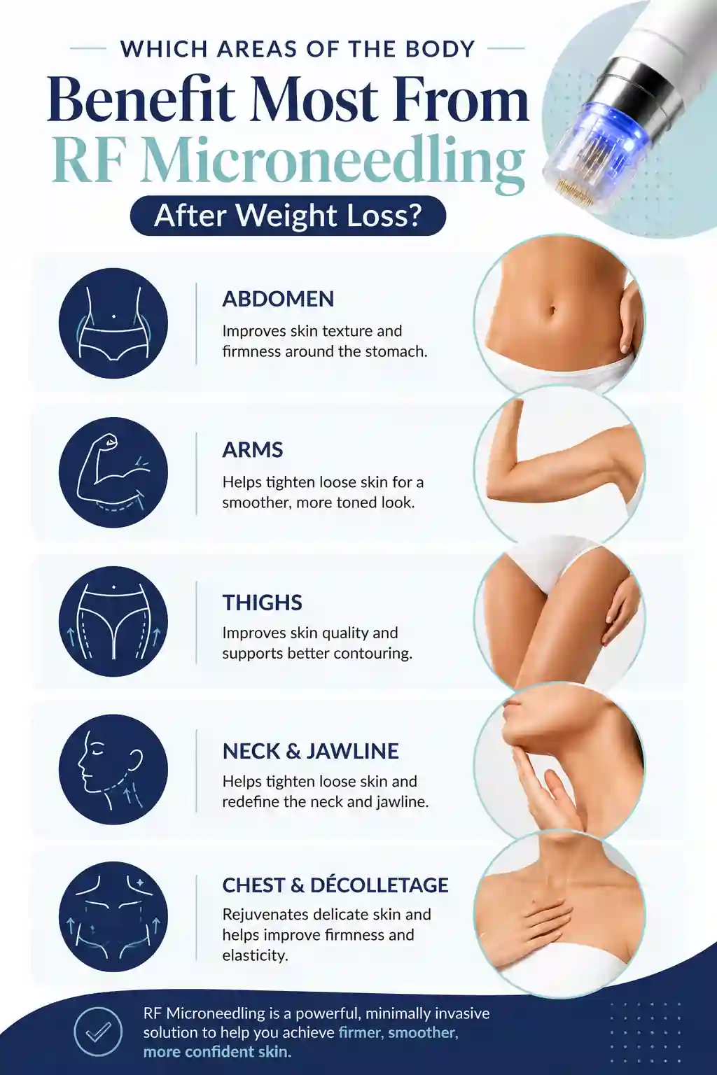 Which Areas of the Body Benefit Most From RF Microneedling After Weight Loss sc